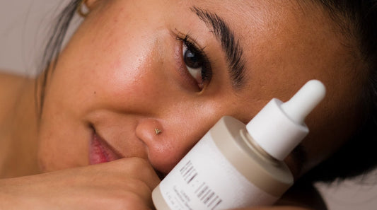 What Causes Hyperpigmentation Spots & How Do You Prevent Them?